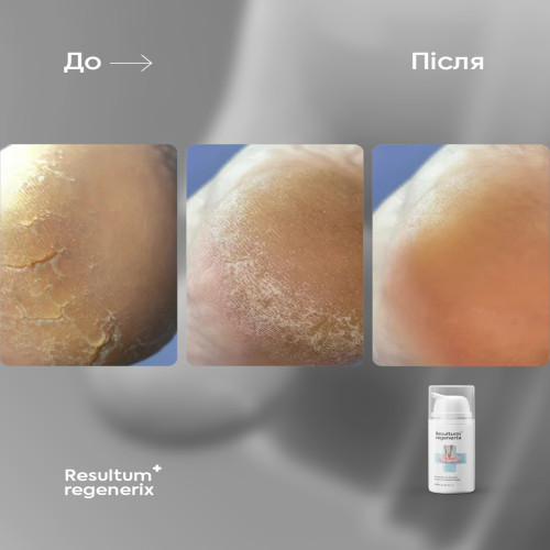 Regenerix, 25 ml Resultum