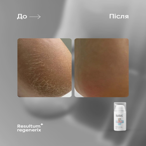 Regenerix, 50 ml Resultum