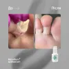 Soleverum, 150 ml Resultum